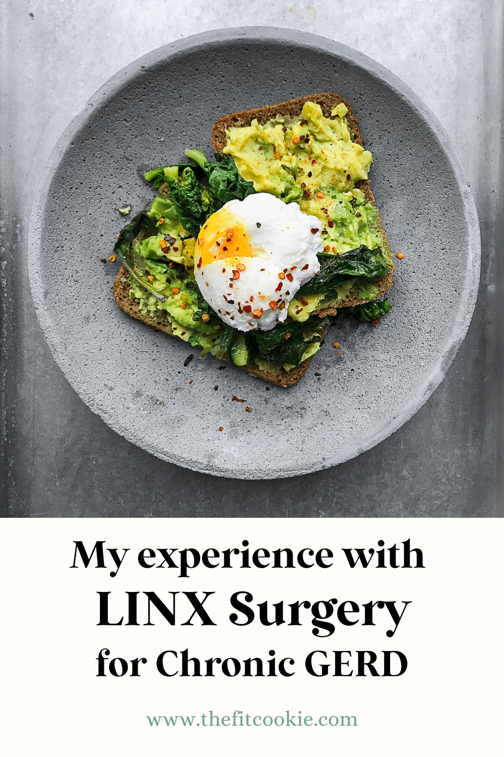overhead photo of a plate of food with text overlay that says "my experience with LINX surgery for chronic GERD".